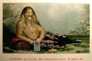 Sideshow Freaks lionel the lion faced man stephan bibrowski Vintage Post Card
