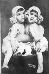 Circus Freak Sideshow Cuban Siamese Twins  1910