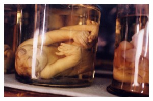 Sideshow Freak Mutter Museum    medical oddities Skulls